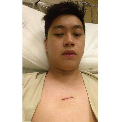 After Biopsy