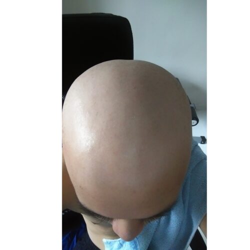 No Hair