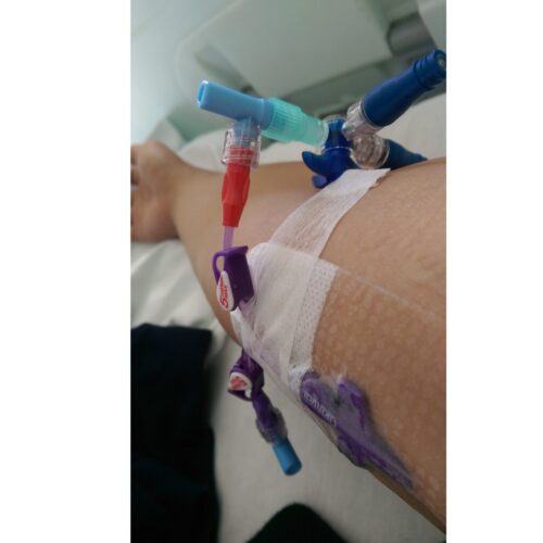 PICC