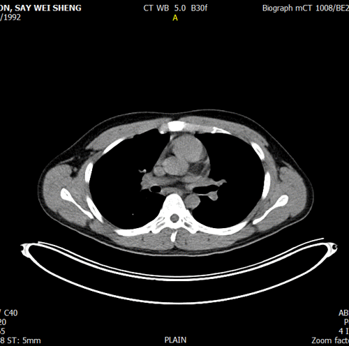 Post Scan